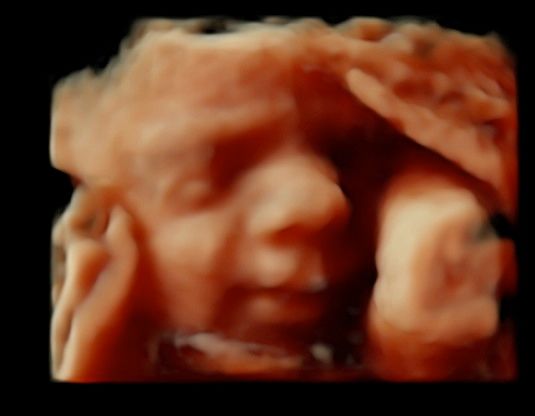 Tommaso Incandela-50