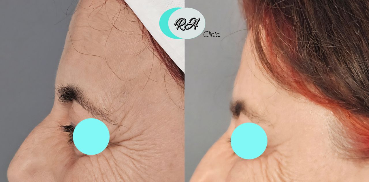 Rosalba Herrero Zerpa-593