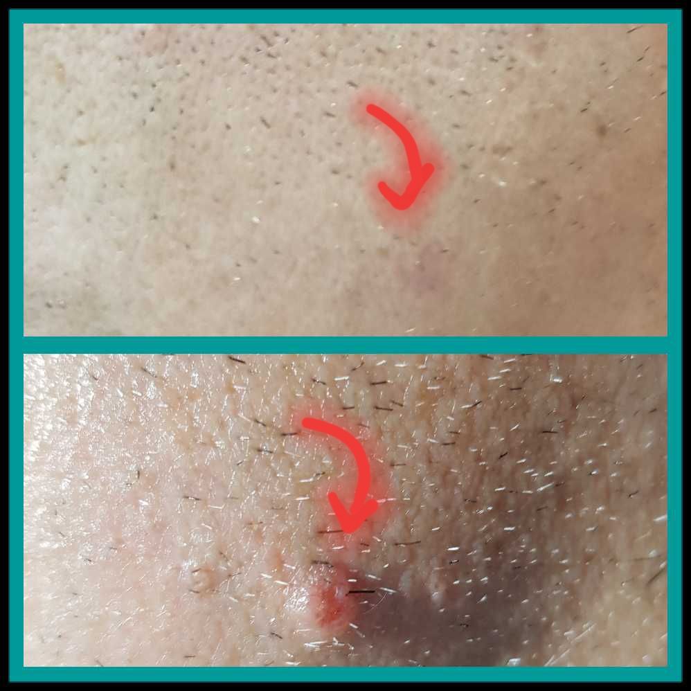 Rosalba Herrero Zerpa-347