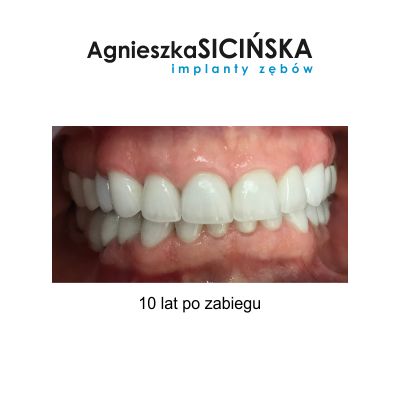 Agnieszka Ewa Sicińska-24