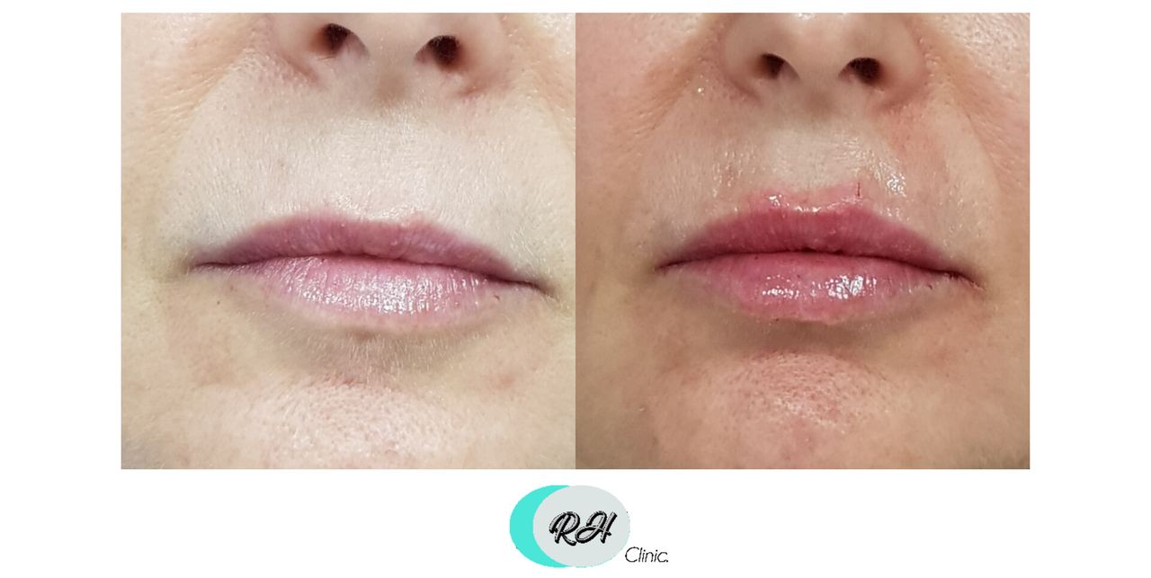 Rosalba Herrero Zerpa-624