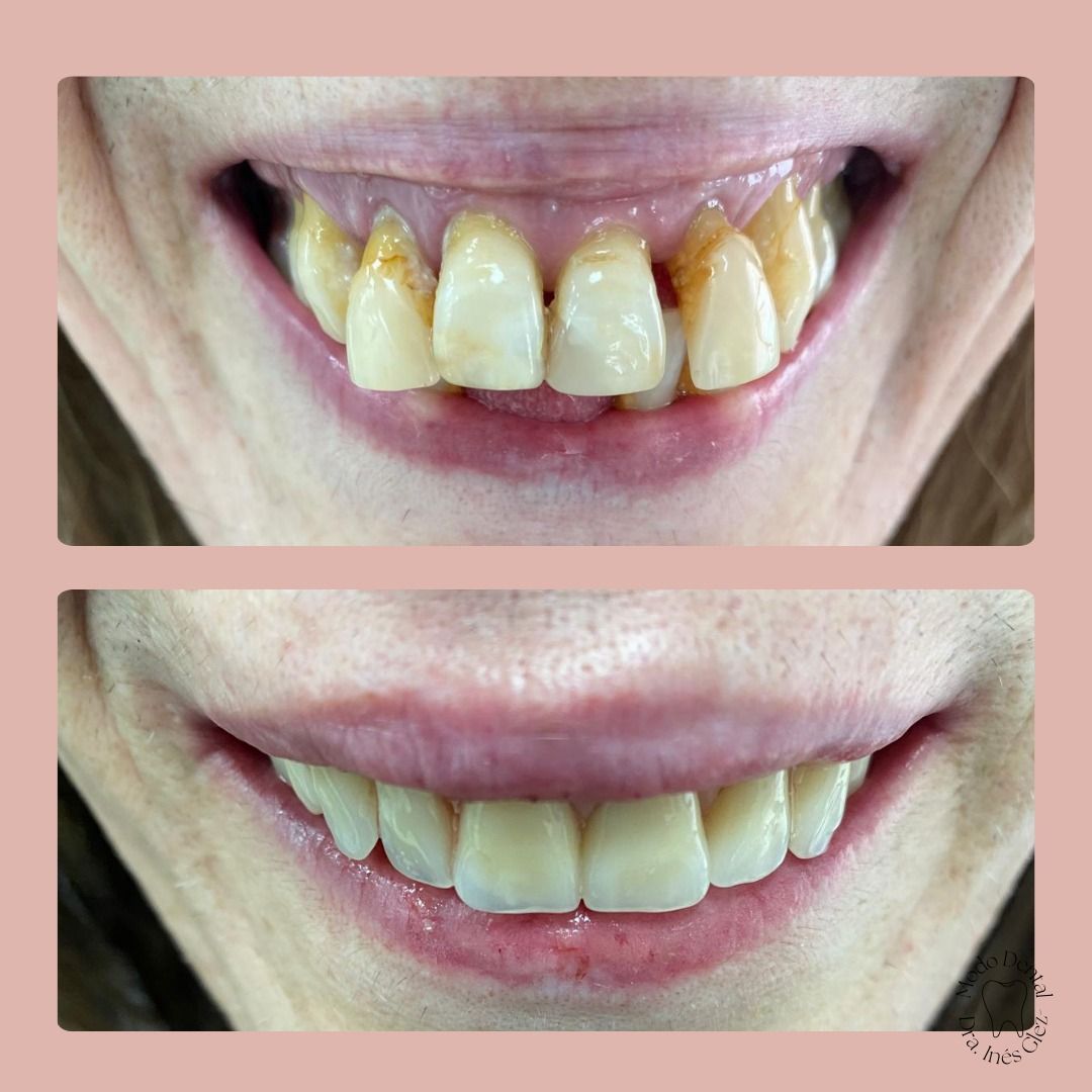 Inés Gonzalez Ordoño-9