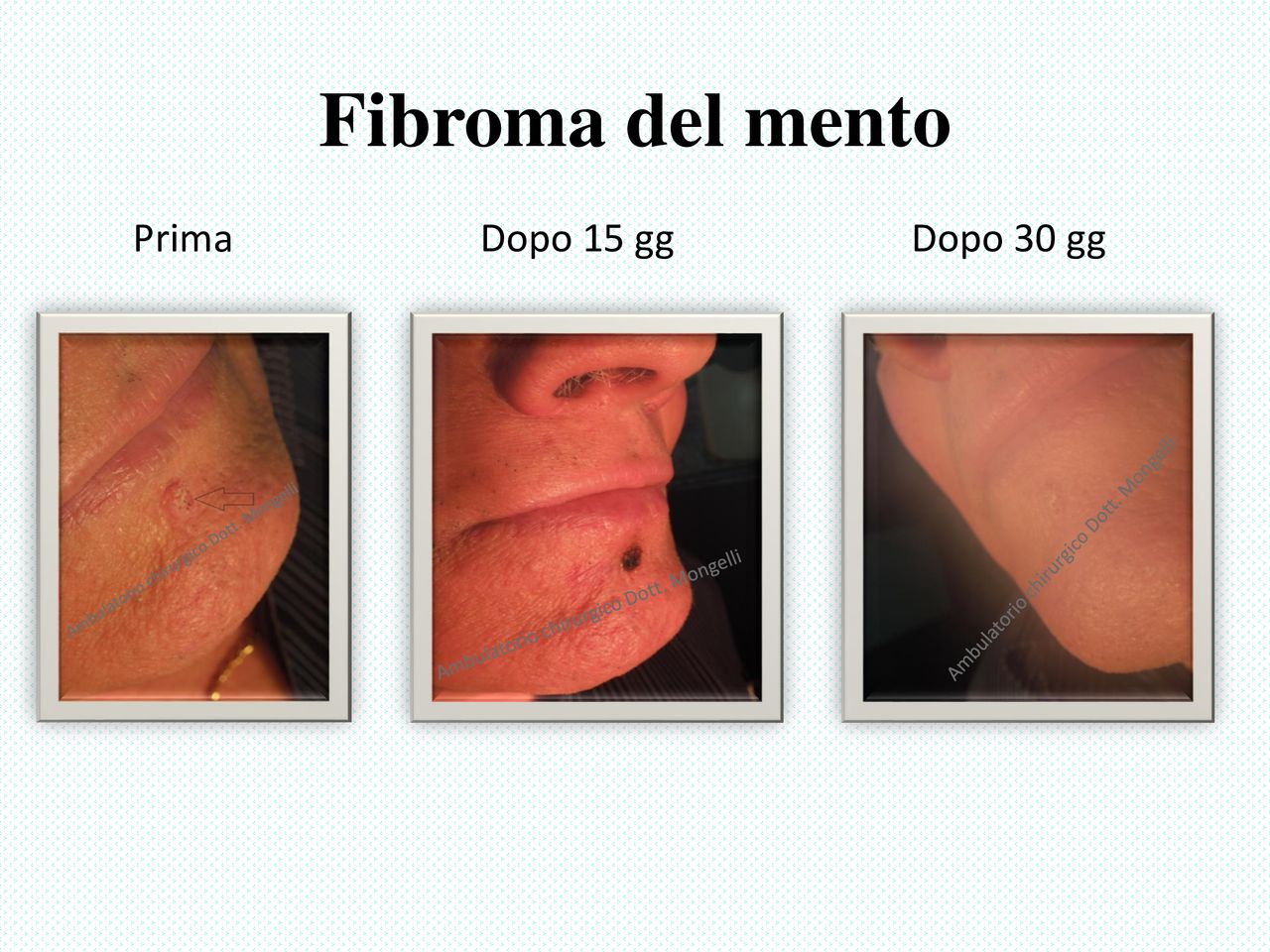 Matteo Antonio Mongelli-12