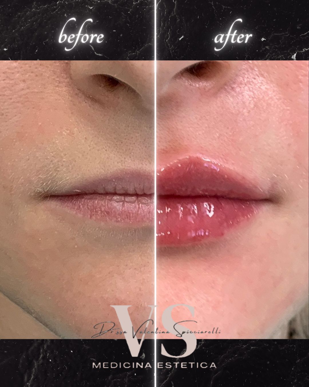 Valentina Spicciarelli-7