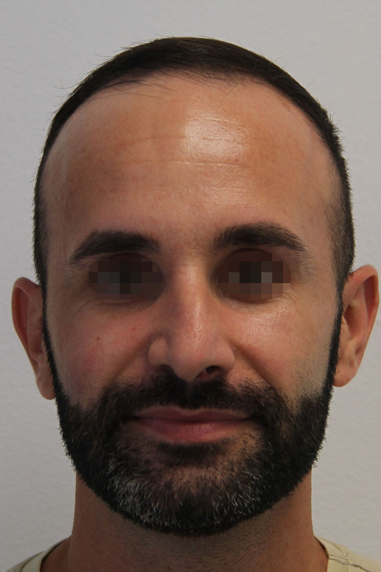 Xavier Barcelo Colomer-21