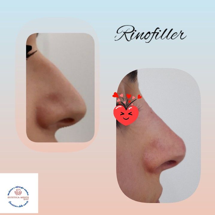 Paola Della Rocca-57