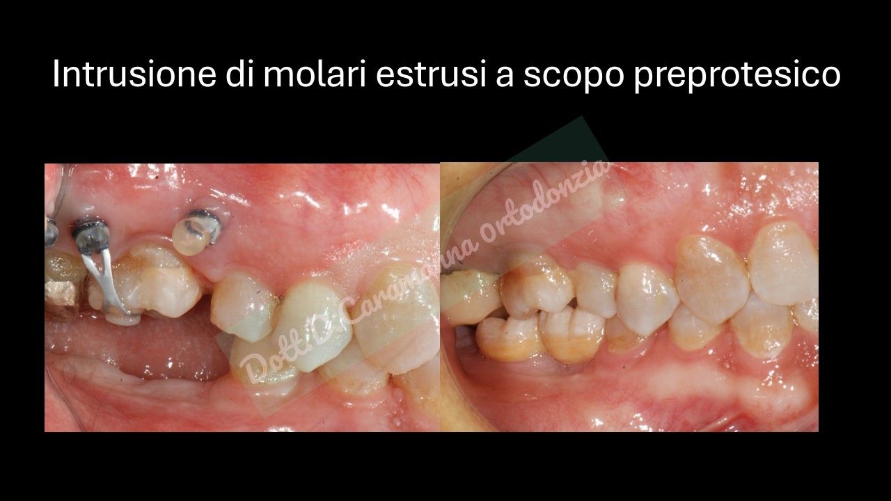 Daniele Caramanna-34