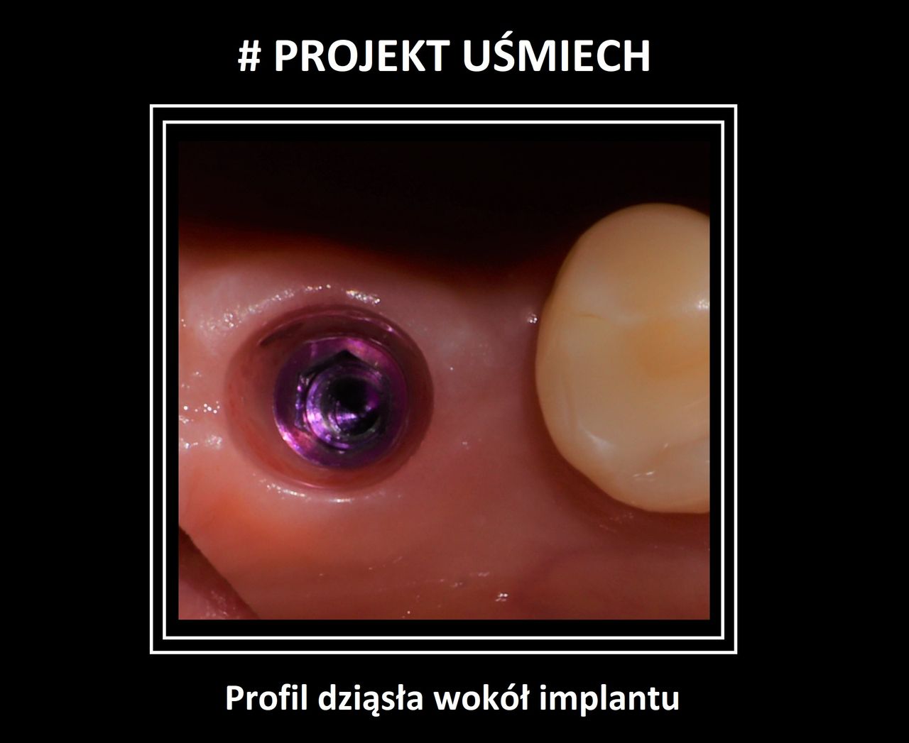 Bartosz Łukasiewicz-4