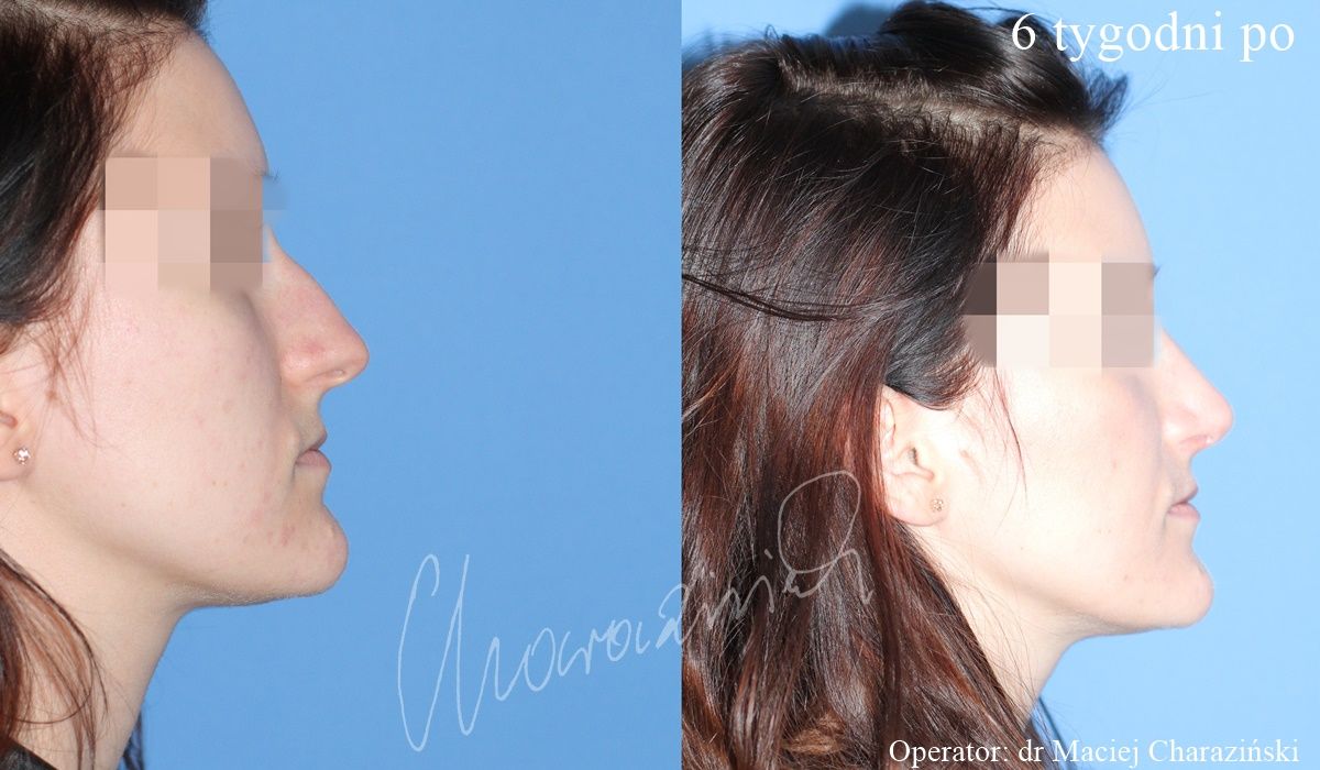 Maciej Charaziński-36