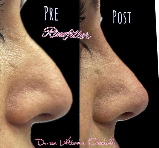 Vittoria Cassioli-24