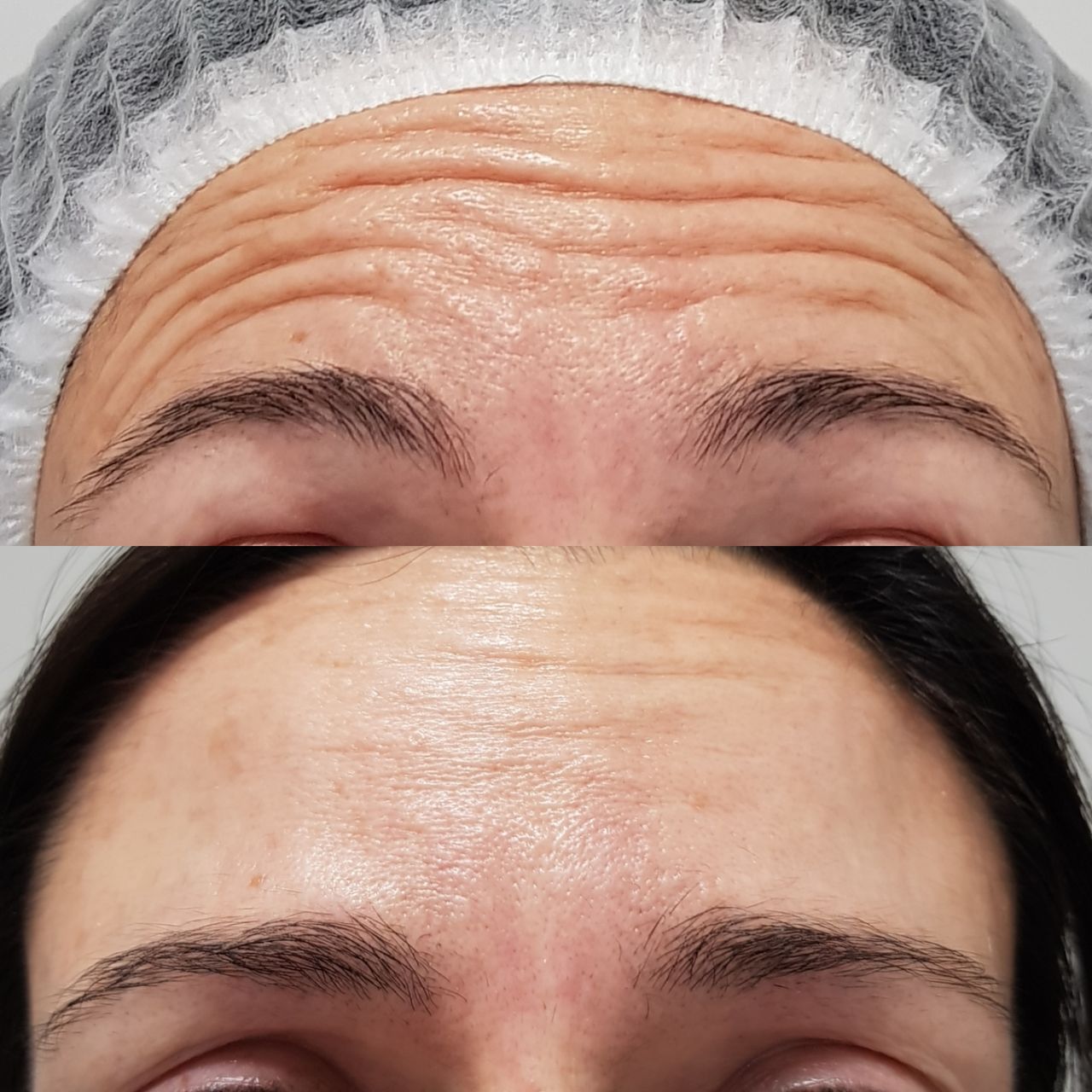 Rosalba Herrero Zerpa-514