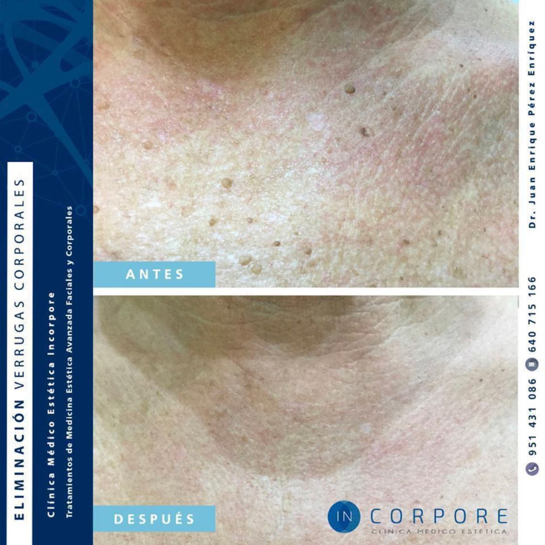 Juan Enrique Pérez Enríquez-119