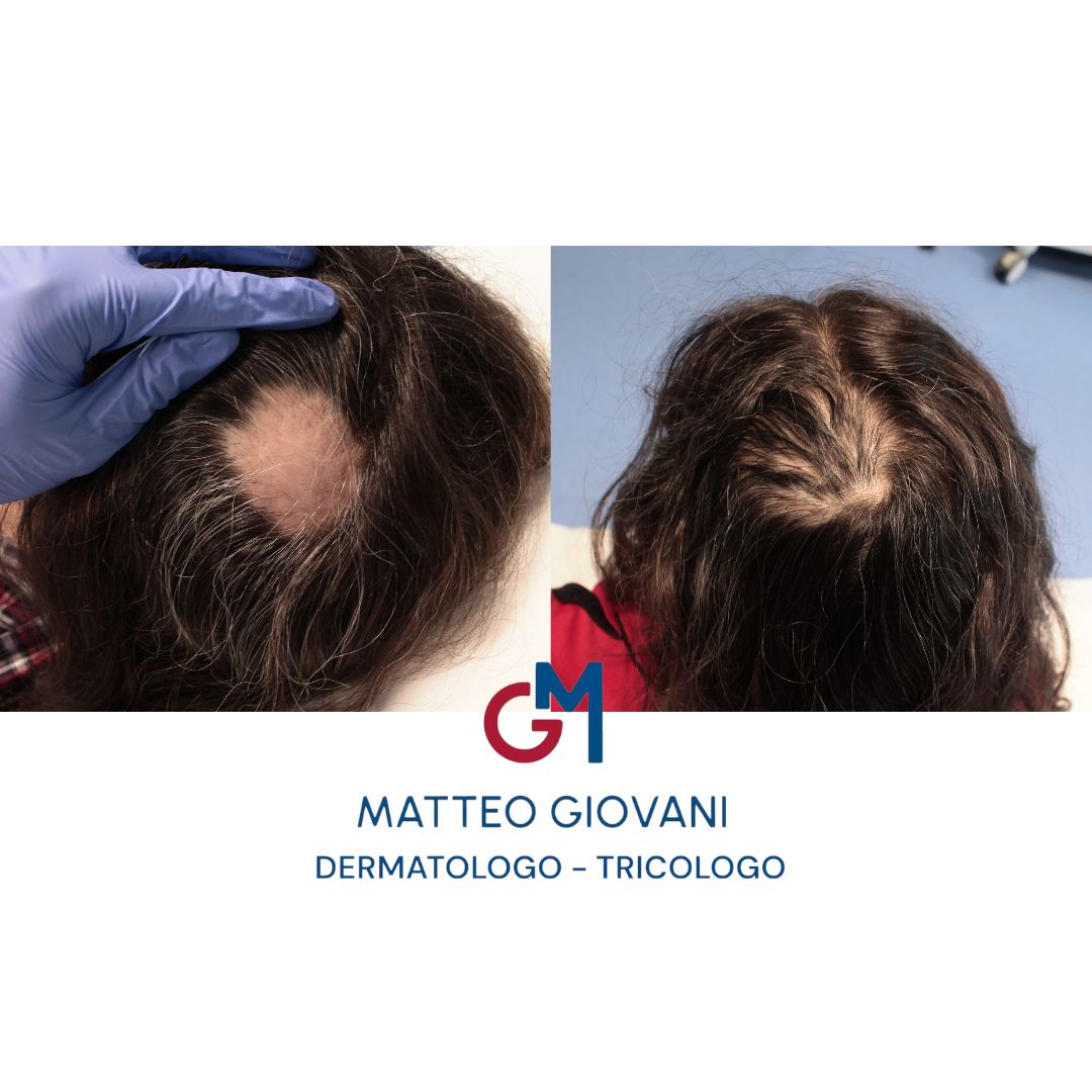 Matteo Giovani-2