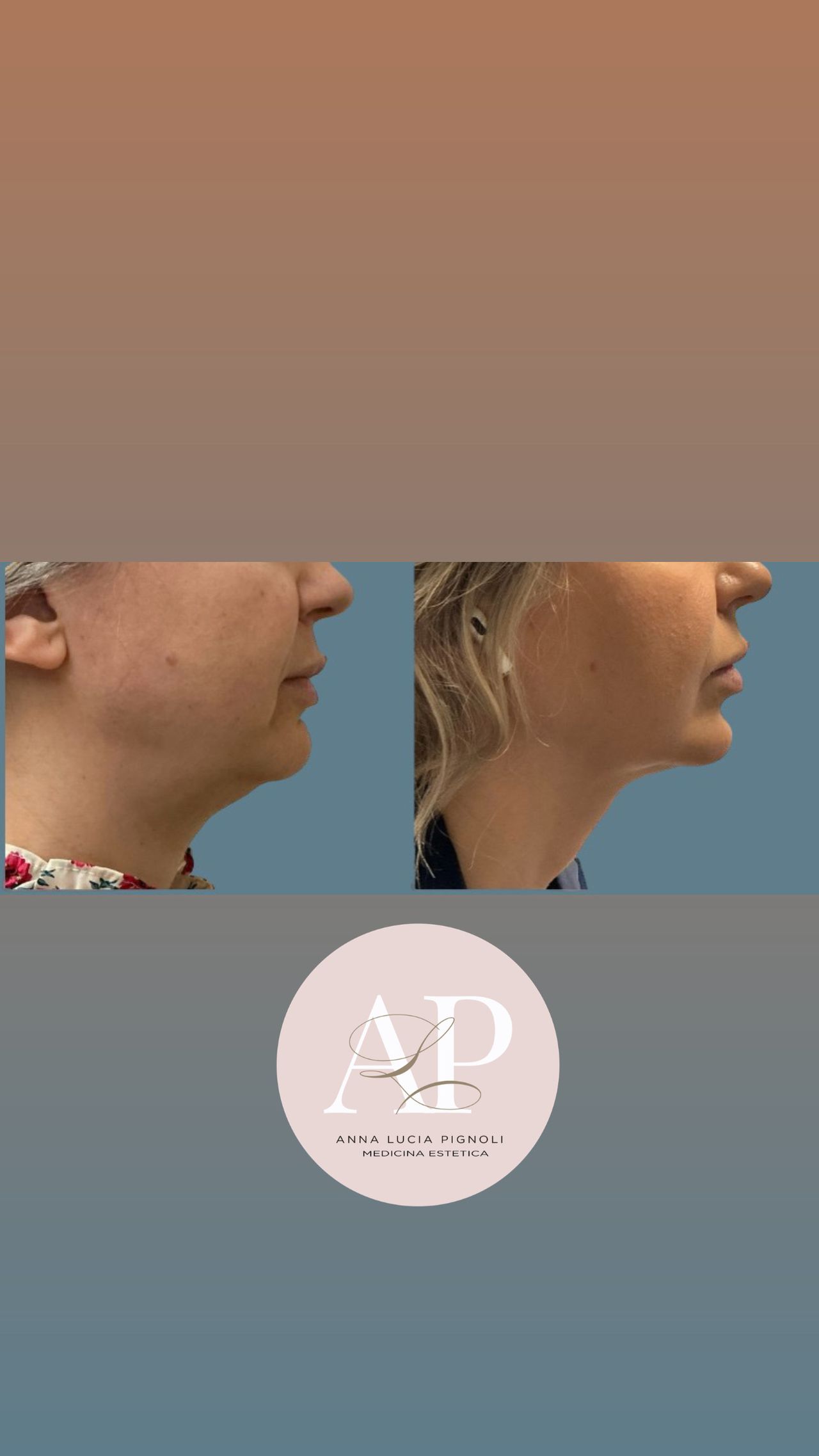 Anna Lucia Pignoli-2