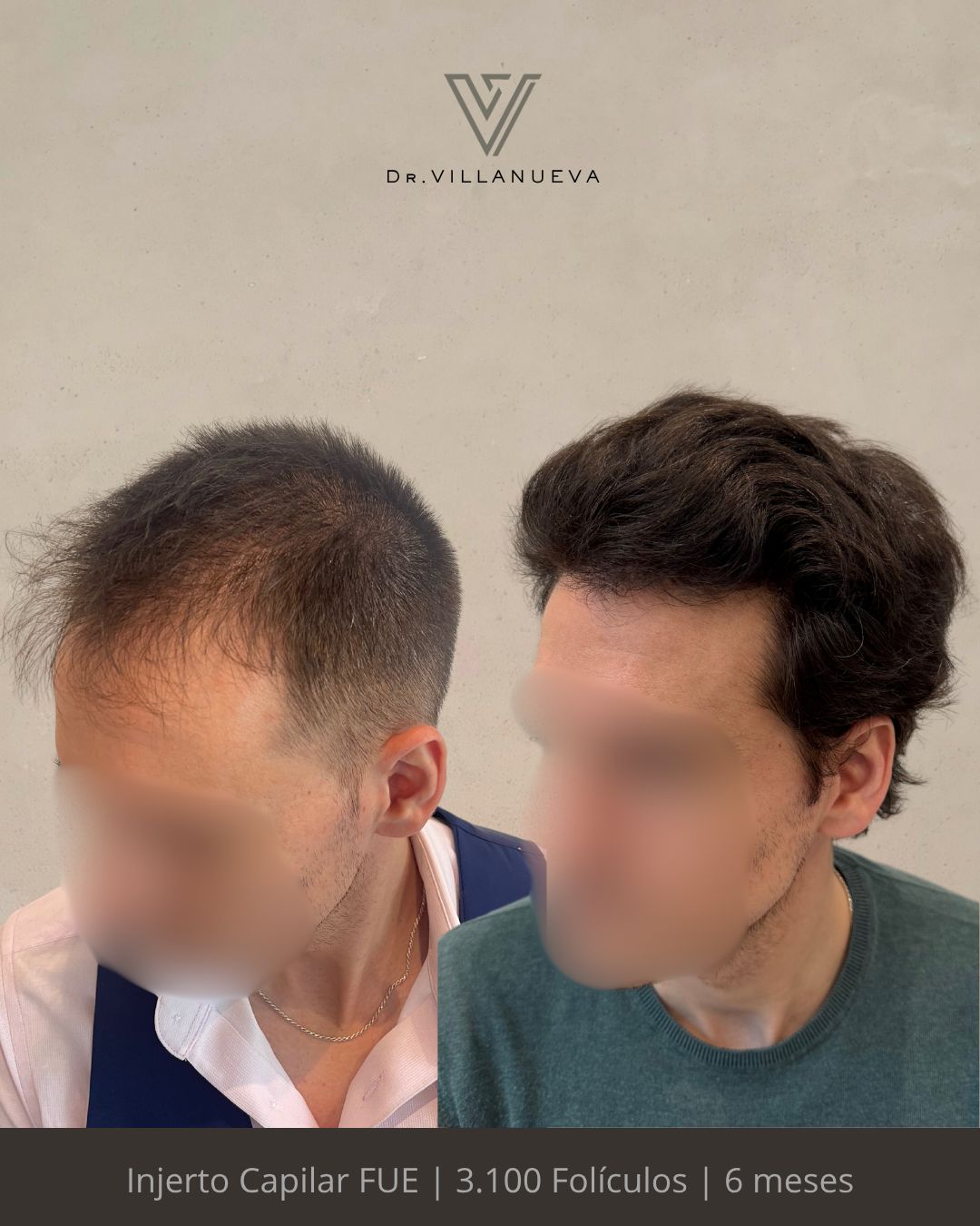 Alfredo Villanueva-8