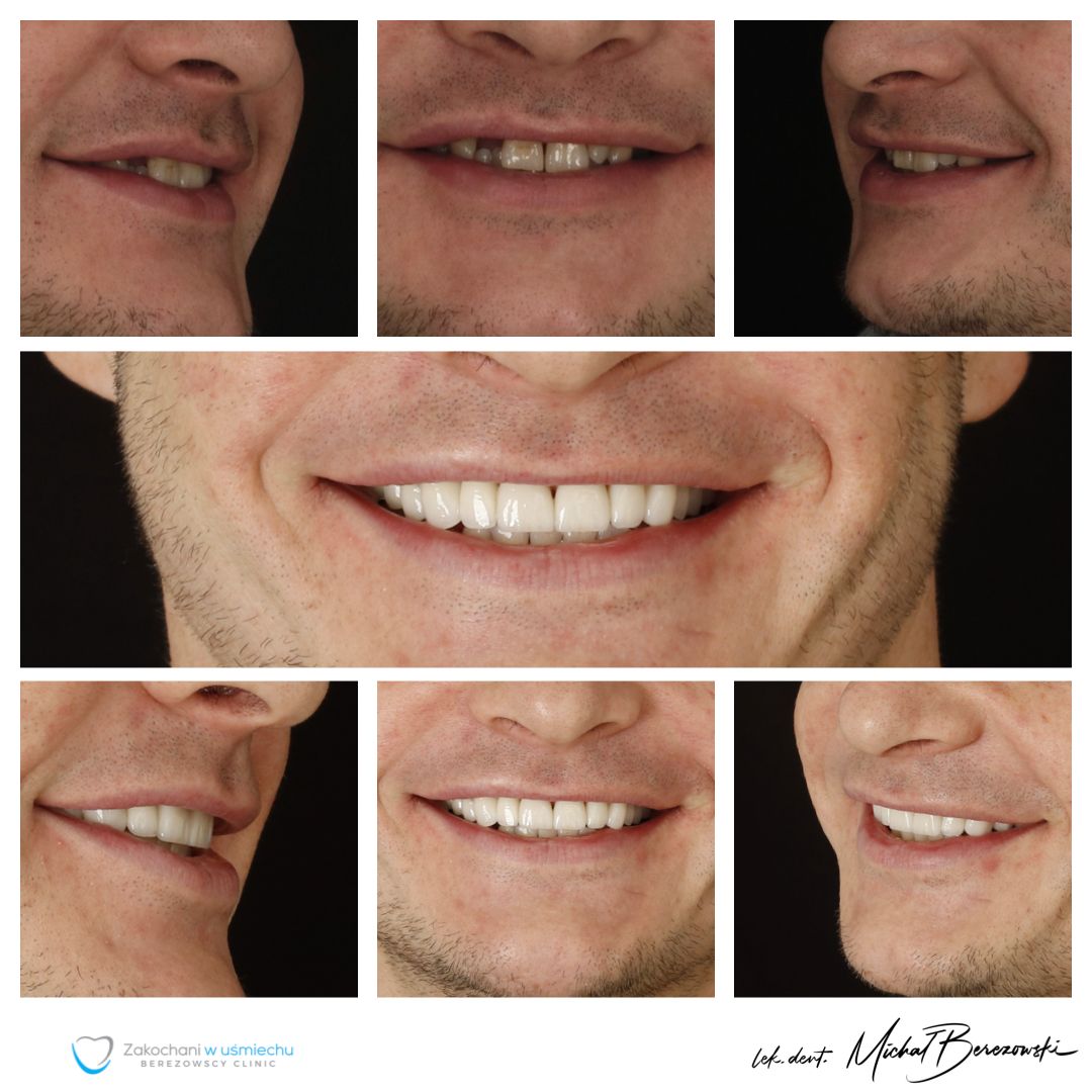 Michał Berezowski-17