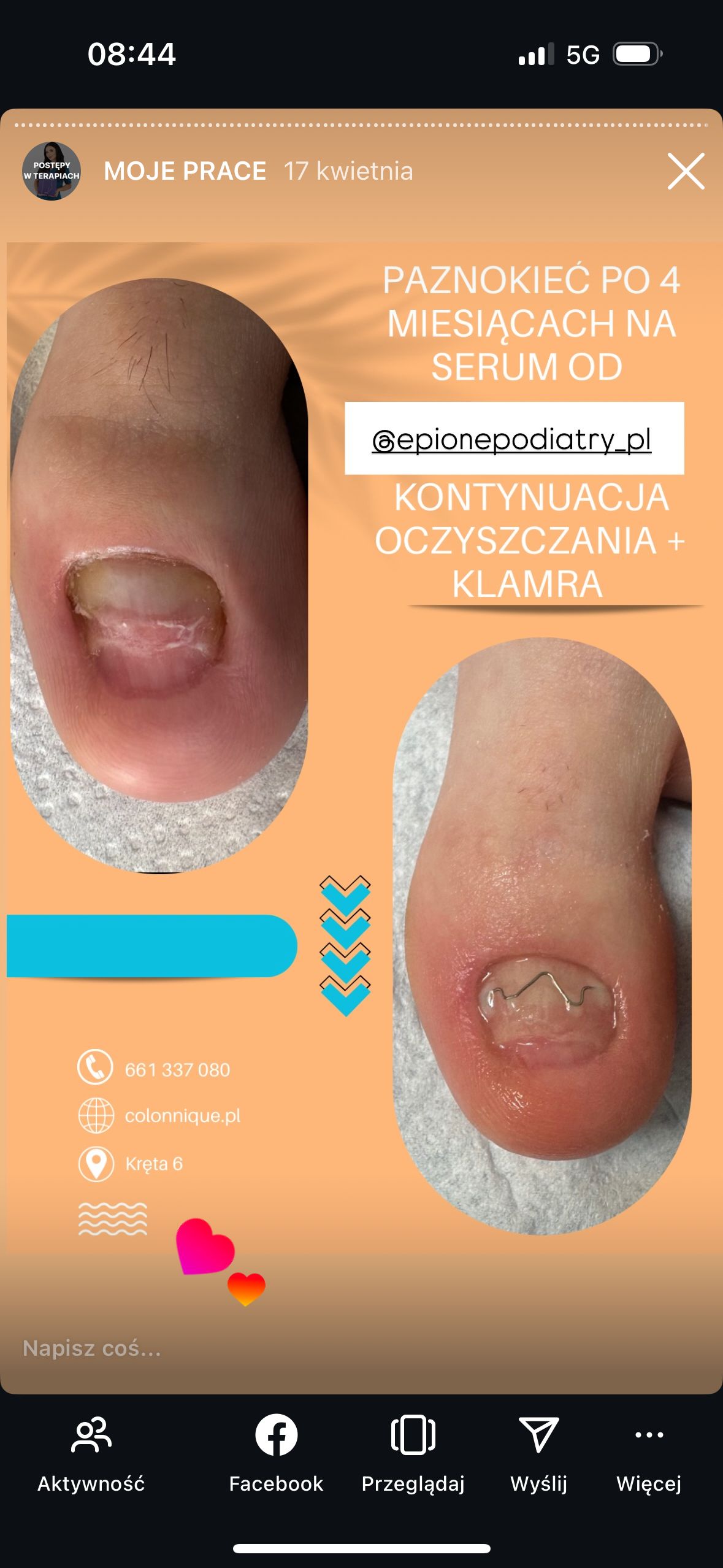 Karolina Colonna-Walewska-0