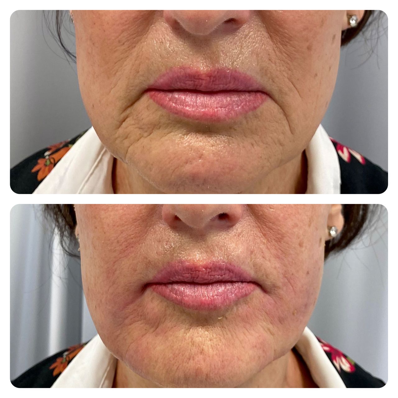 Elisabetta Fabiani-97