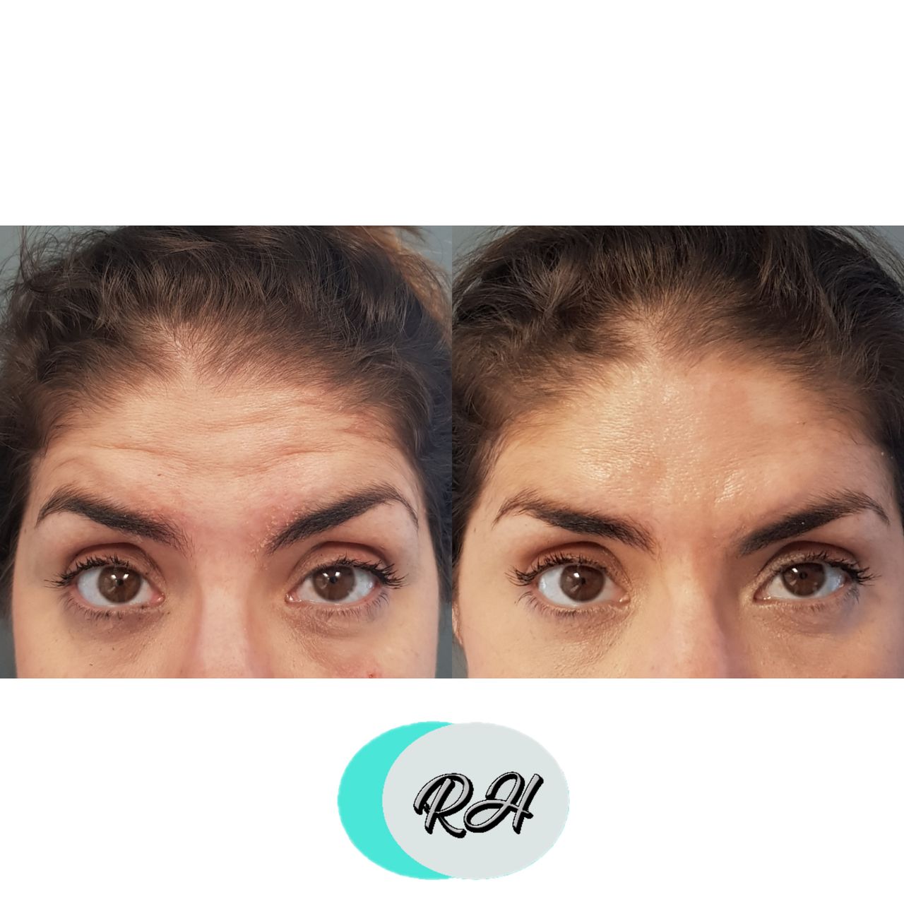 Rosalba Herrero Zerpa-185