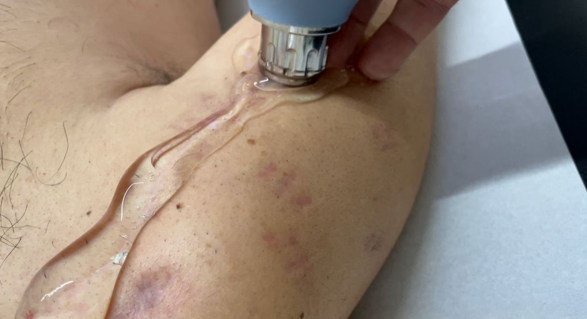 Giuseppe Lombardo-50