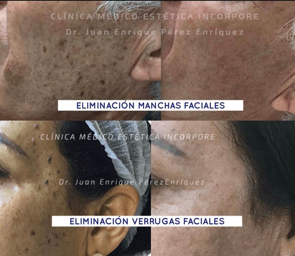 Juan Enrique Pérez Enríquez-62