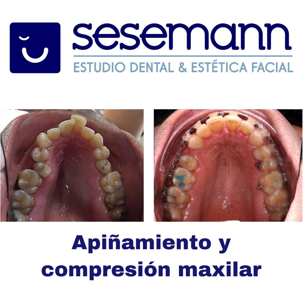 Paula Cano Carrillo-115