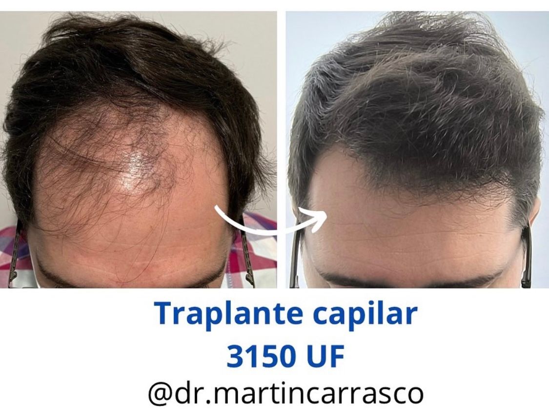 Pablo Martín Carrasco-3