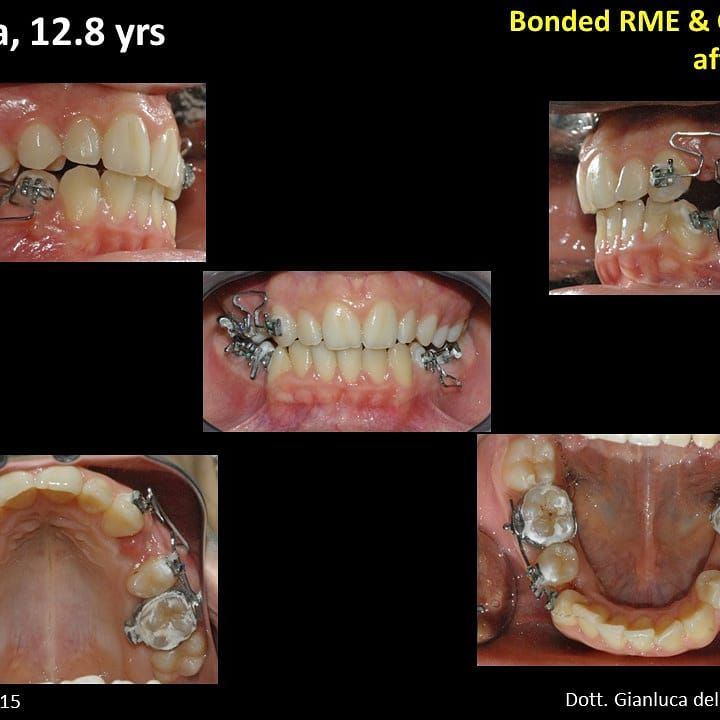Gianluca Del Vecchio-80