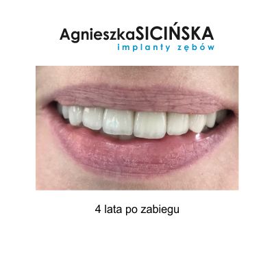 Agnieszka Ewa Sicińska-27