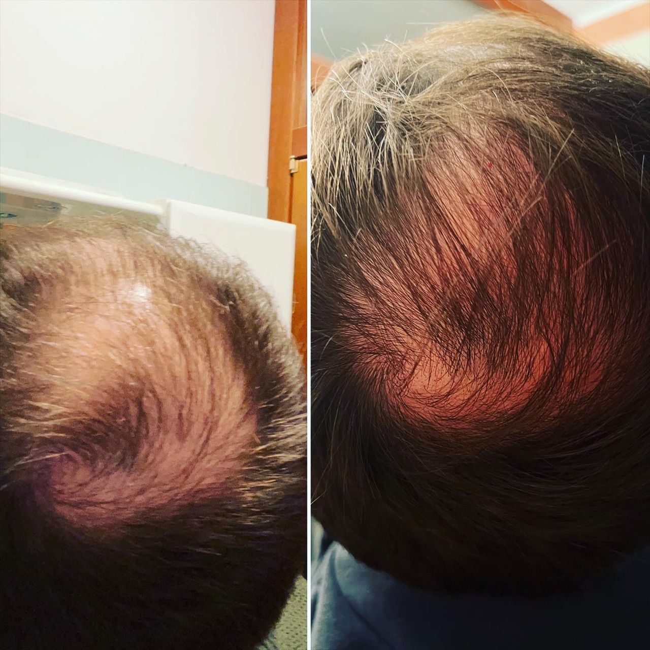 Jacopo Pettinelli-18