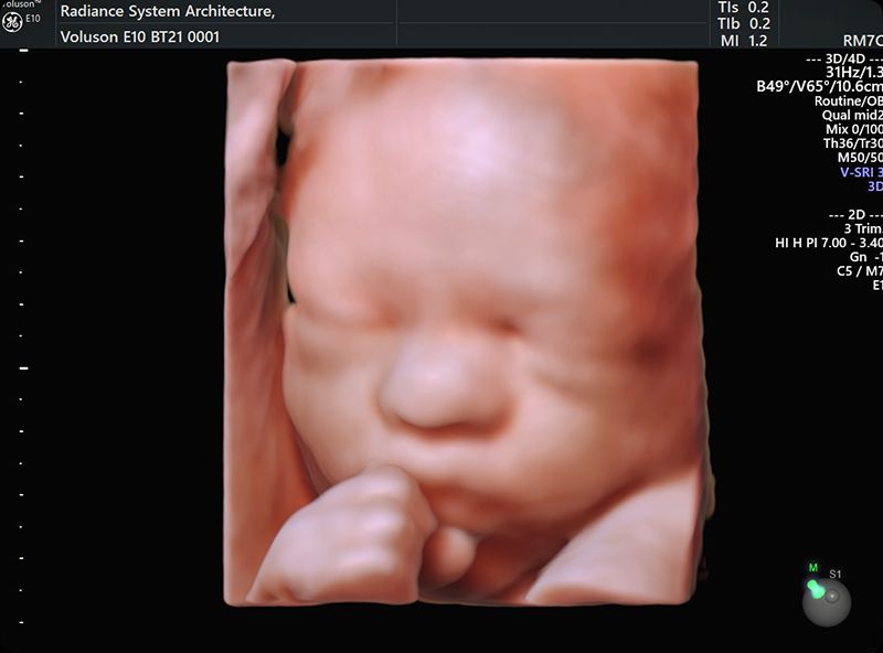 Annaclaudia Masini-5