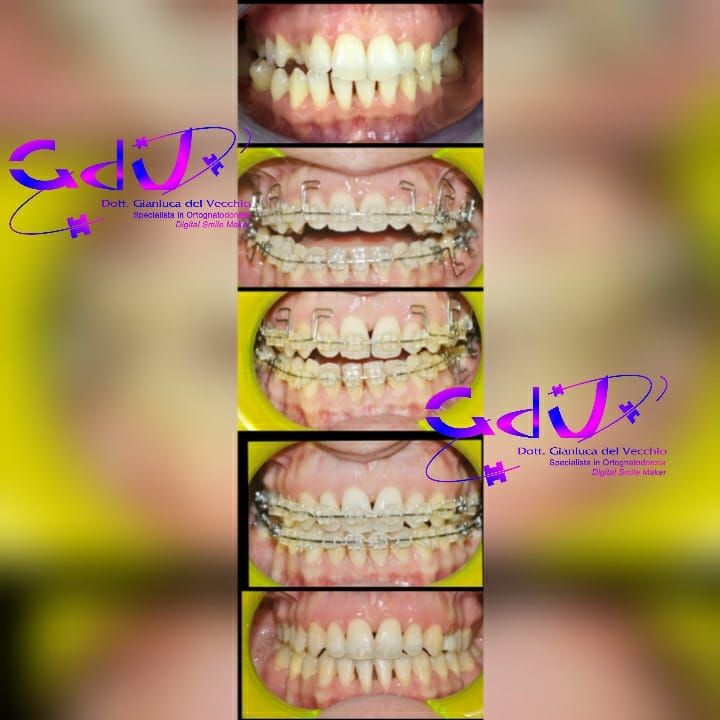 Gianluca Del Vecchio-125