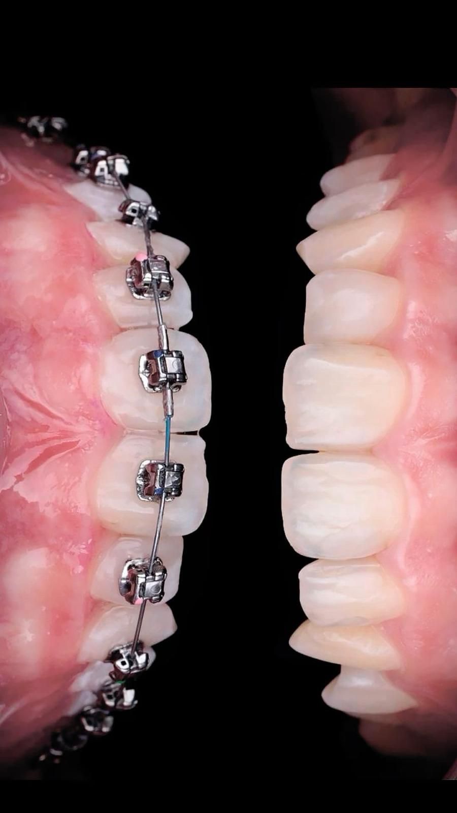 Alba López Laraño-3