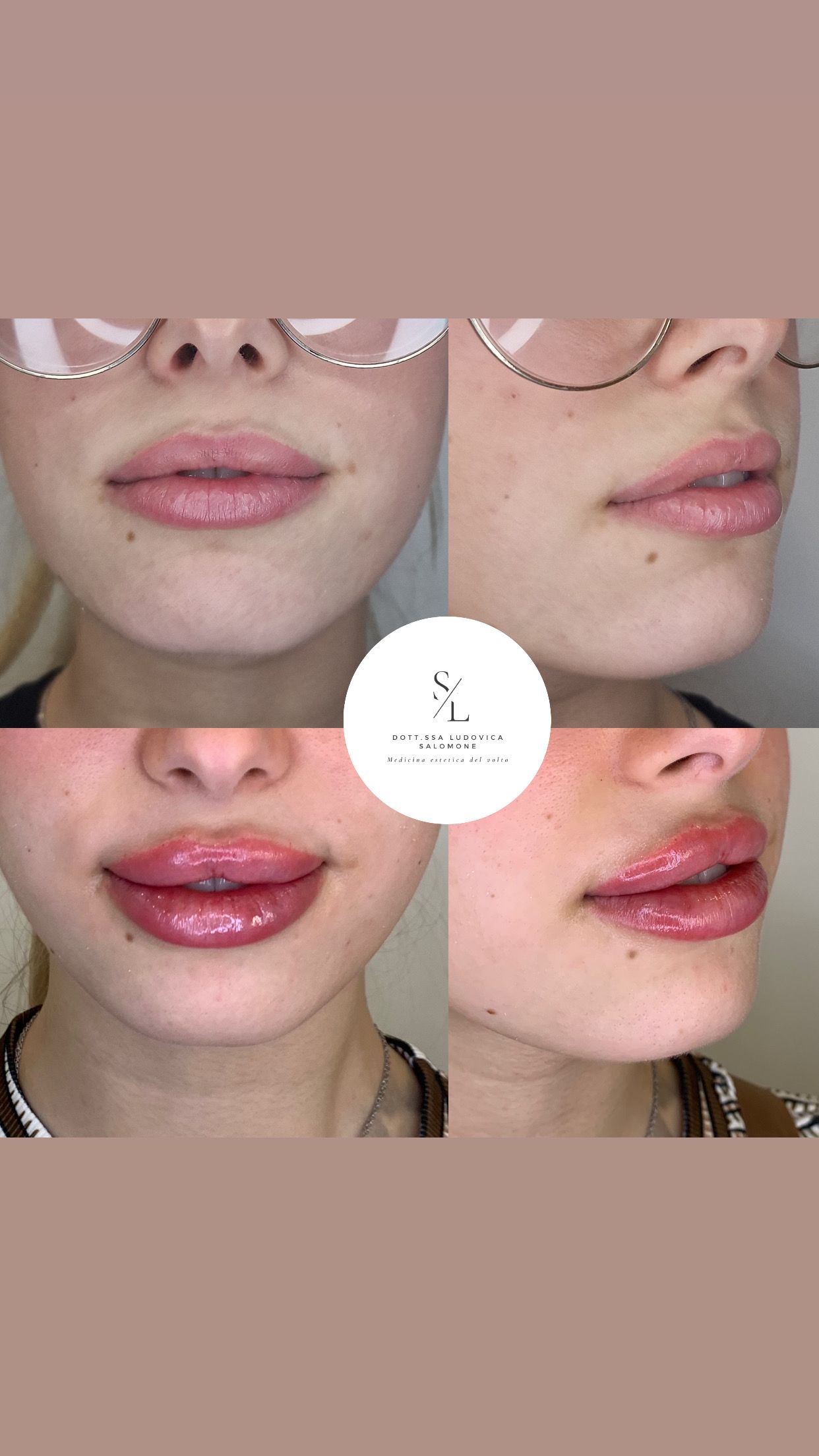 Ludovica Salomone-6