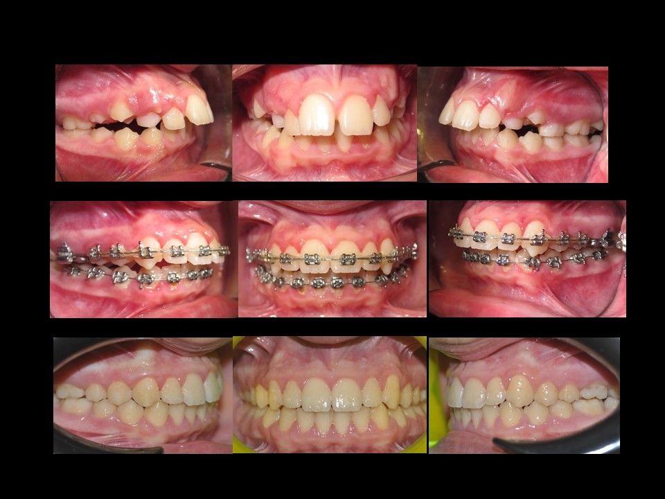 Gianluca Del Vecchio-8