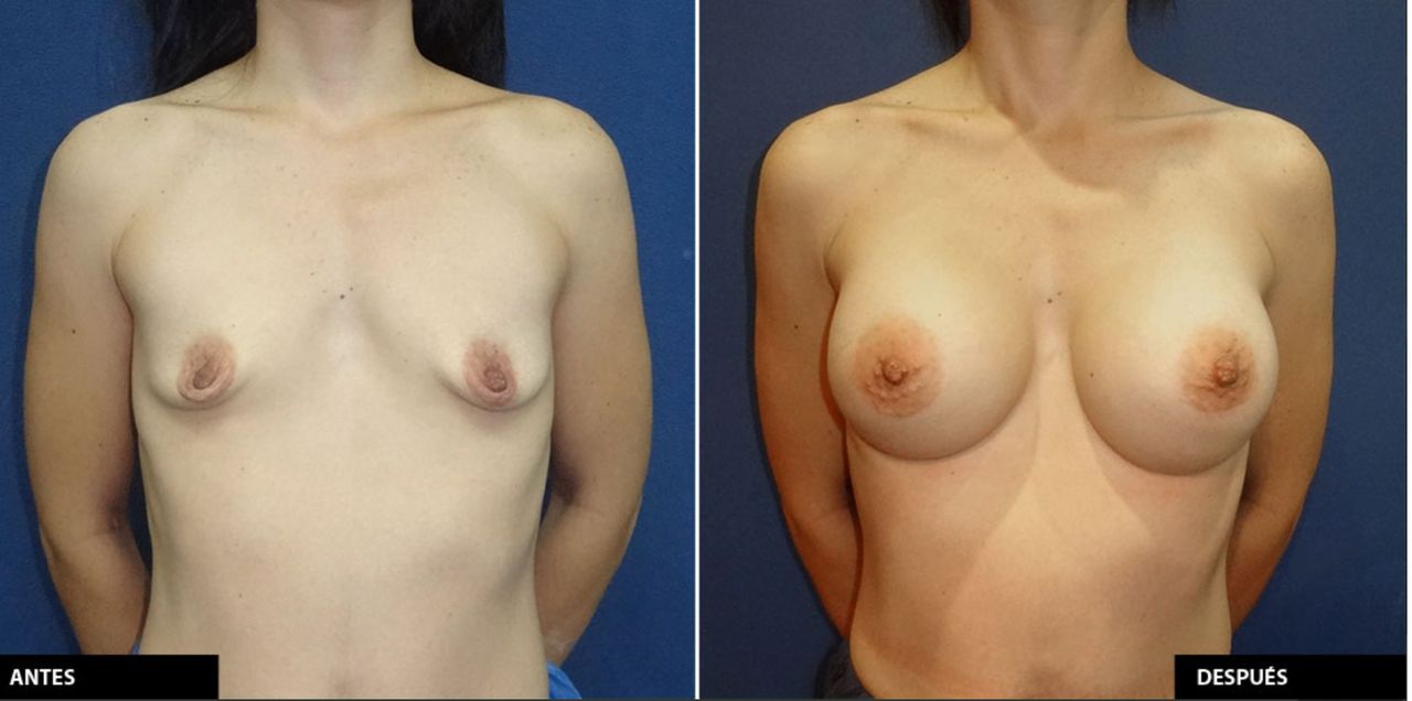 Jaime Eduardo Chacón Hernández-1