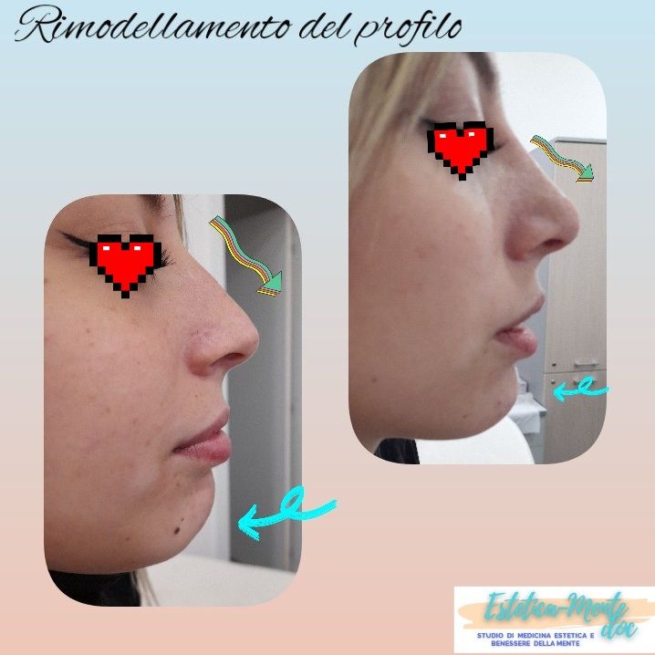 Paola Della Rocca-51