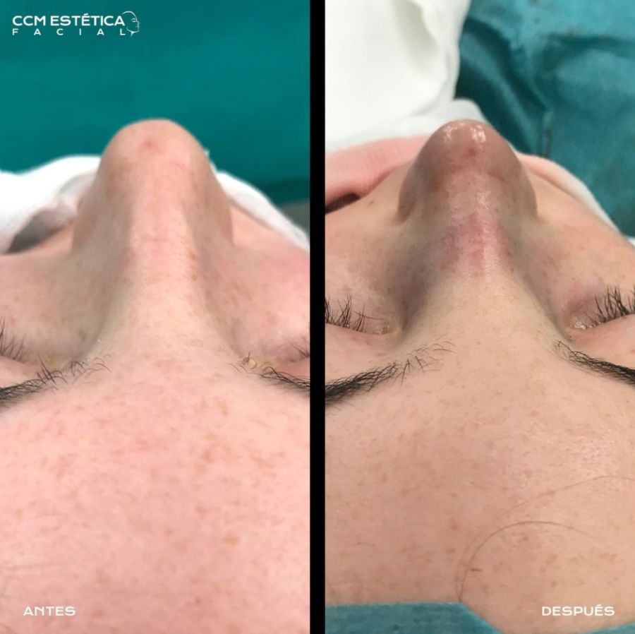 Alvaro Perez Villar-11