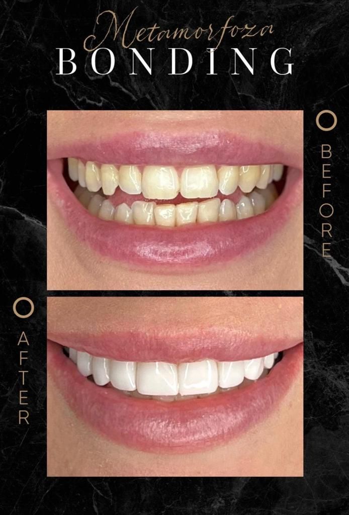 Agata Amelia Defińska-23