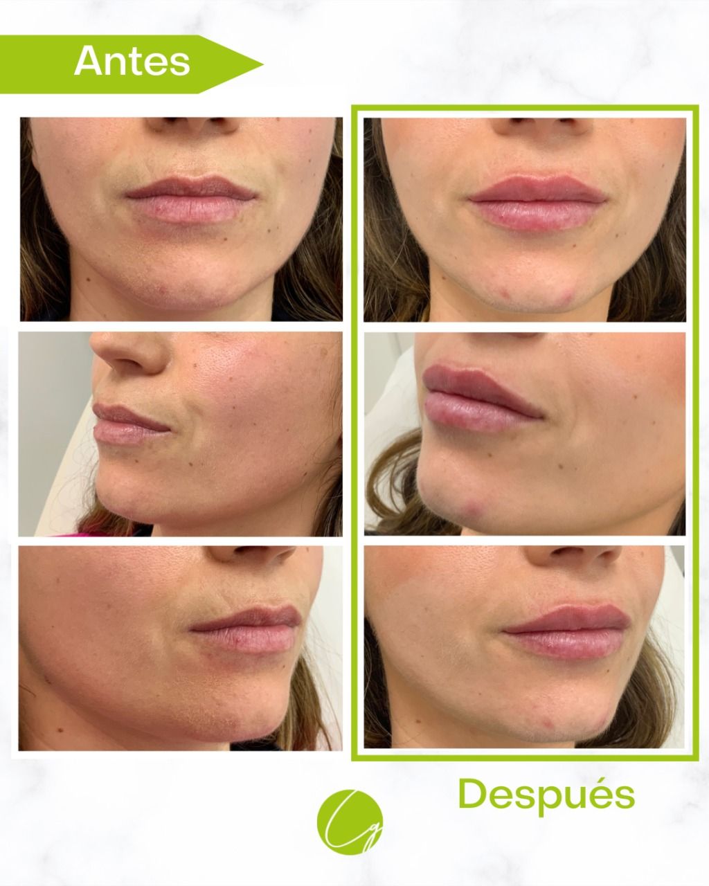 Raquel Gómez García-8