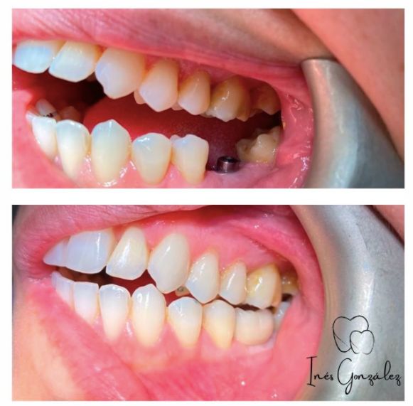 Inés Gonzalez Ordoño-8