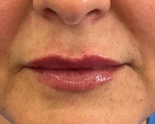 Alessandra Simonitto-10