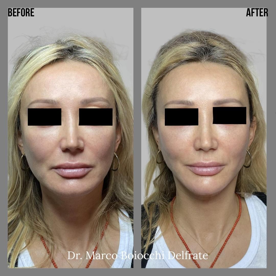 Marco Boiocchi Delfrate-1