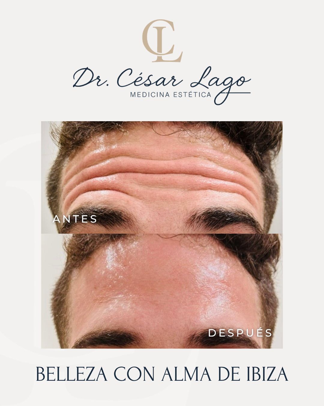 César Lago-6
