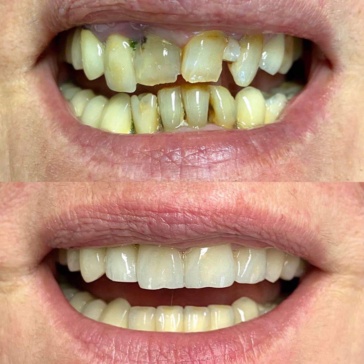 Annibale Donnarumma-4