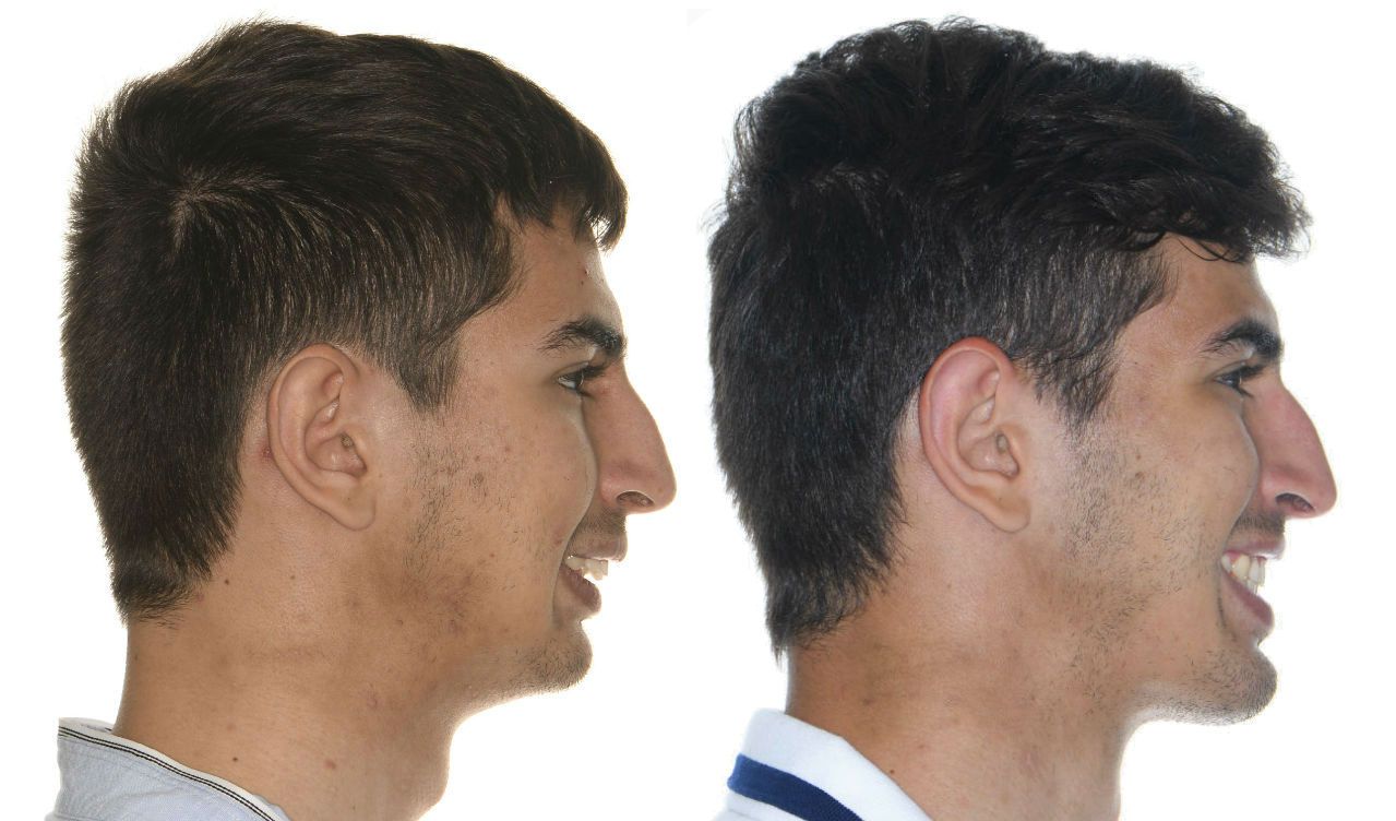 Federico Hernández Alfaro-7