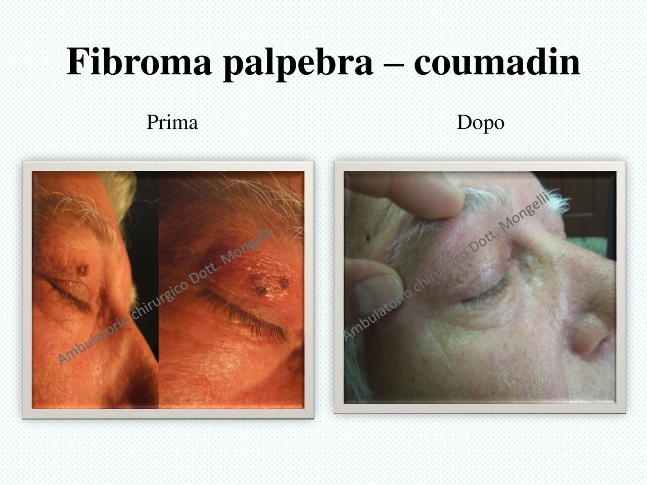 Matteo Antonio Mongelli-14