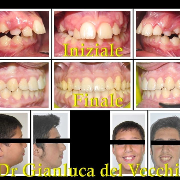 Gianluca Del Vecchio-27