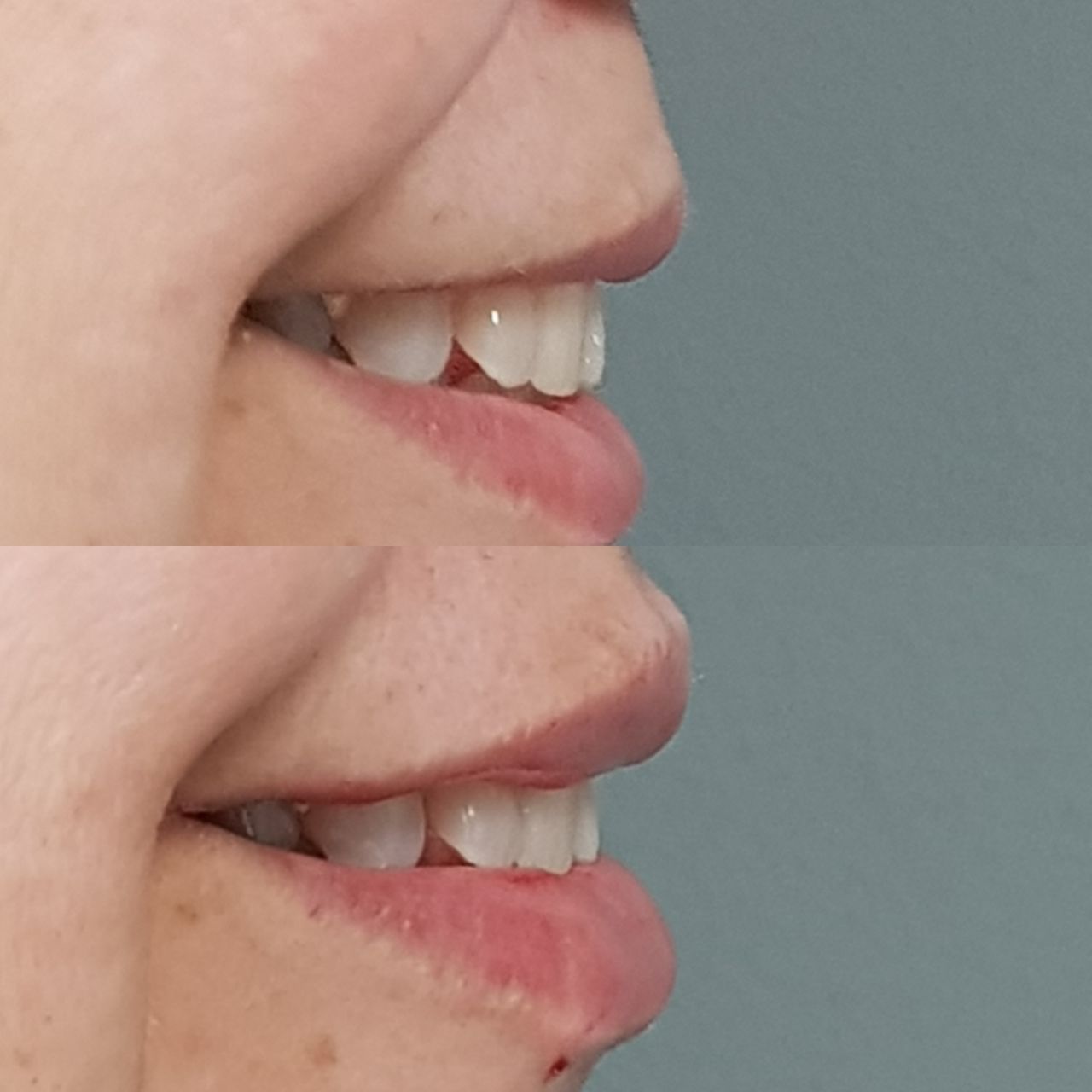 Rosalba Herrero Zerpa-227