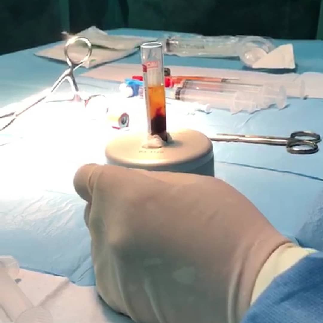 Ramiro Diego Abran-82